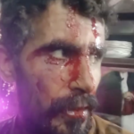 تھانہ دھمیال کی حدود میں پولیس مقابلہ، فائرنگ سے زخمی ملزم گرفتار، دو ساتھی فرار