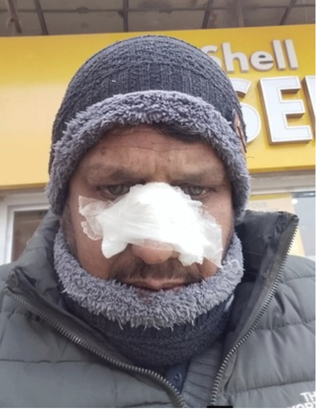 راولپنڈی: خونی بسنت کا خوفناک واقعہ، قاتل ڈور سے ٹریفک پولیس آفیسر شدید زخمی