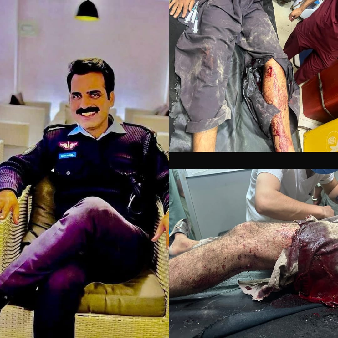 سبزی منڈی پولیس کا کامیاب آپریشن: خطرناک اسنیچر و ڈاکو گروہ کے دو ملزمان زخمی حالت میں گرفتار
